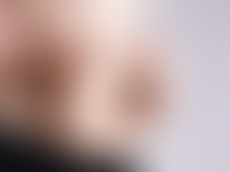 Mini Abdominoplasty for Post-Pregnancy Body Refinement