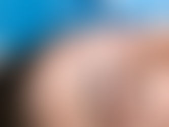 Non-Invasive Eye Rejuvenation