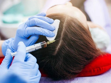 Real Results from Proven Hair Loss Therapies