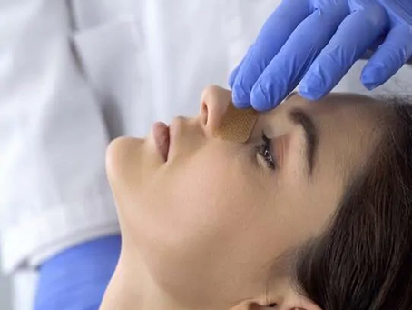 Innovative Rhinoplasty Techniques Delivering Natural Results