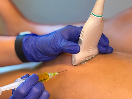 Get Back on Your Feet with PRP Knee Injections