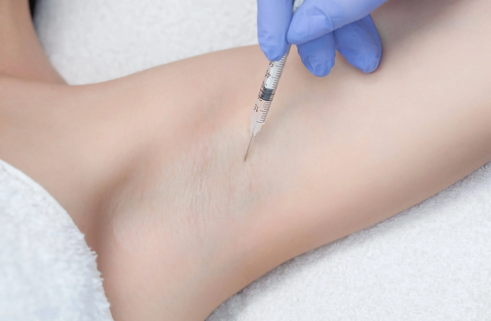 Advanced Botox Treatment for Excessive Sweating