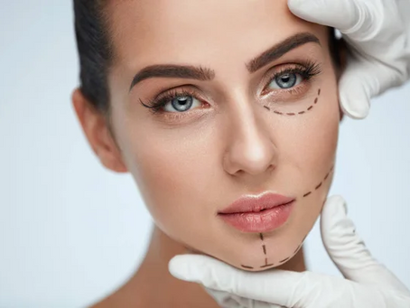 Modern Facelifts Precision, Care, and Elegance