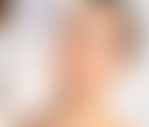 Glow Like Never Before with Skin Injections