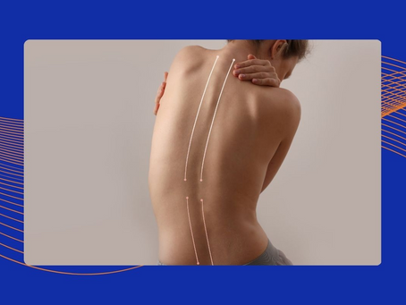 Scoliosis Treatment: What You Should Know