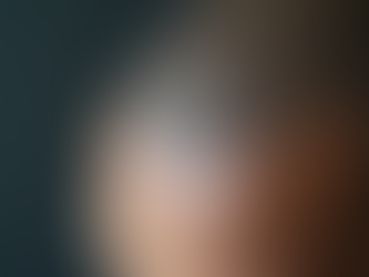 Exploring Scalp Micropigmentation for Hair Loss in Newport Beach.