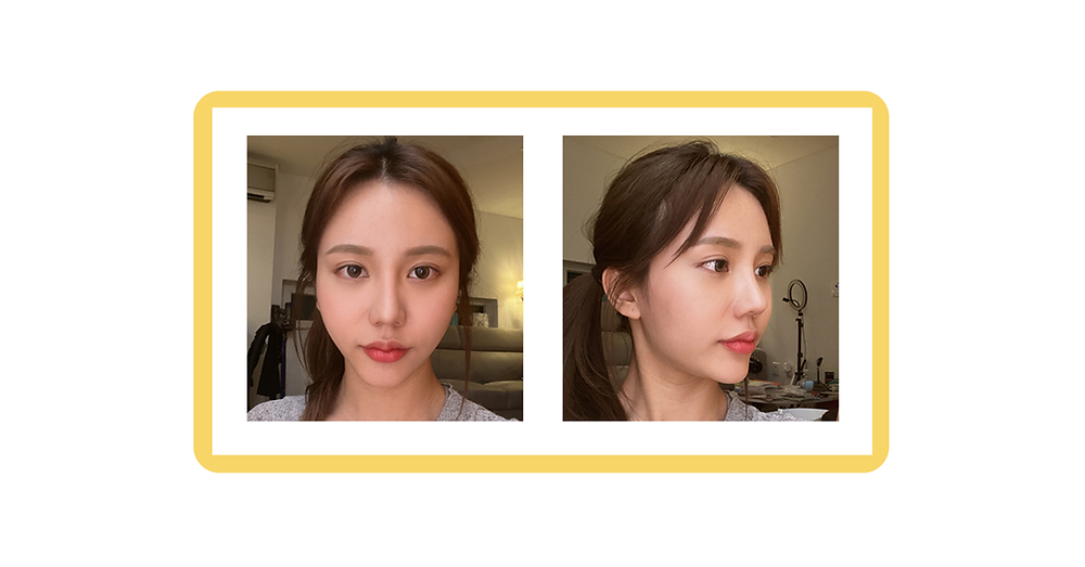 โรงพยาบาลศัลยกรรมวันเปอร์เซ็นต์ ( 1% PLASTIC SURGERY )