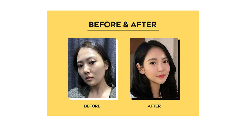 โรงพยาบาลศัลยกรรมวันเปอร์เซ็นต์ ( 1% PLASTIC SURGERY )