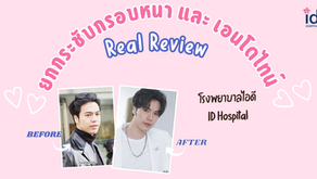 รีวิวศัลยกรรมยกกระชับกรอบหน้า และ เอนโดไทน์ ที่โรงพยาบาลไอดี ID Hospital