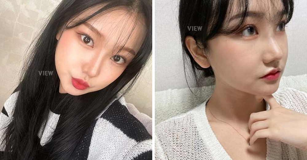 โครงหน้า 3 จุด / เสริมจมูก / ทำตาสองชั้น โรงพยาบาลวิว VIEW Plastic Surgery