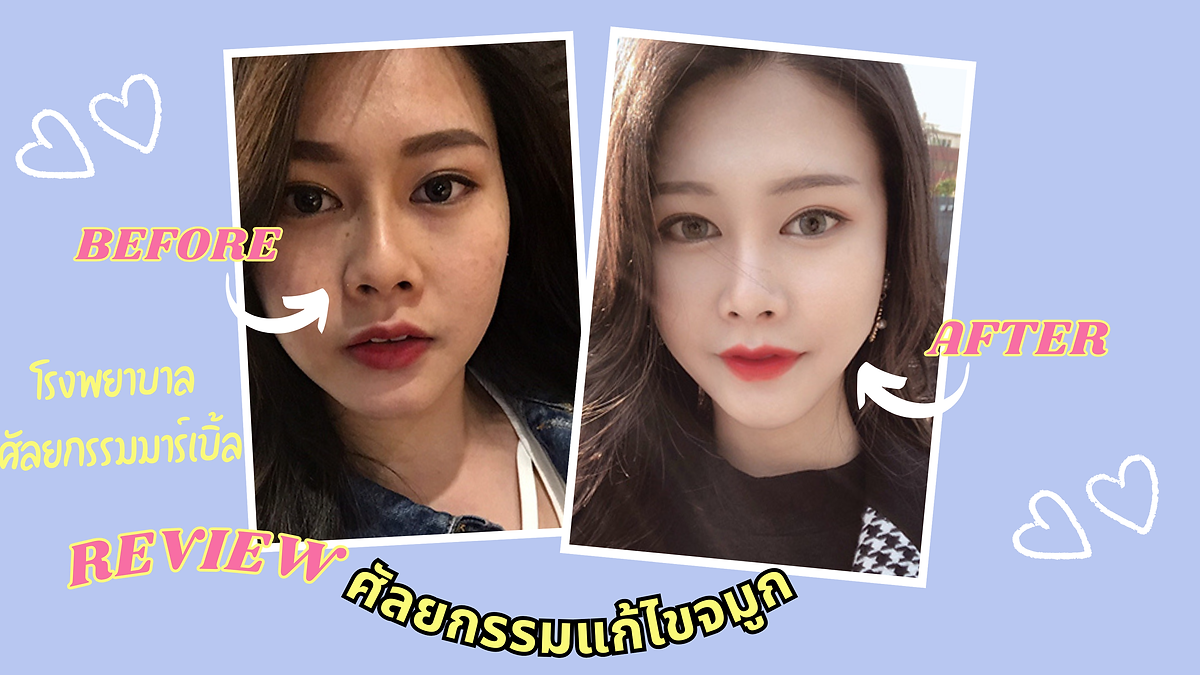 Cover image for the Korean plastic surgery hospitals section