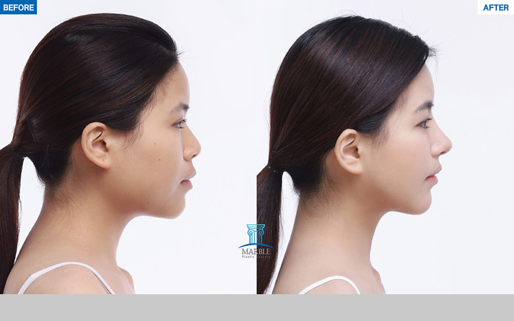 | BEFORE AFTER