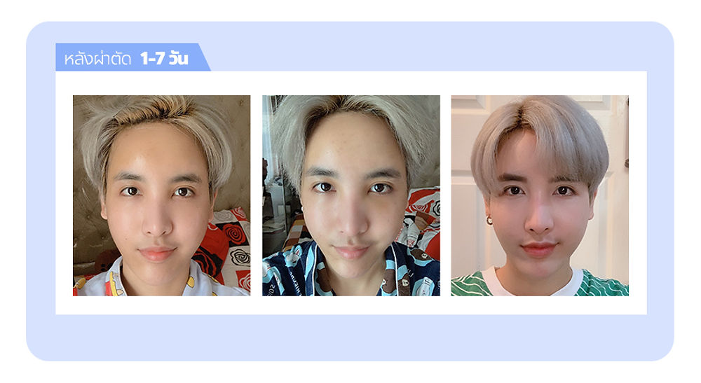 สวย หล่อ ครบจบในที่เดียว โรงพยาบาลศัลยกรรมมาร์เบิ้ล MARBLE PLASTIC SURGERY