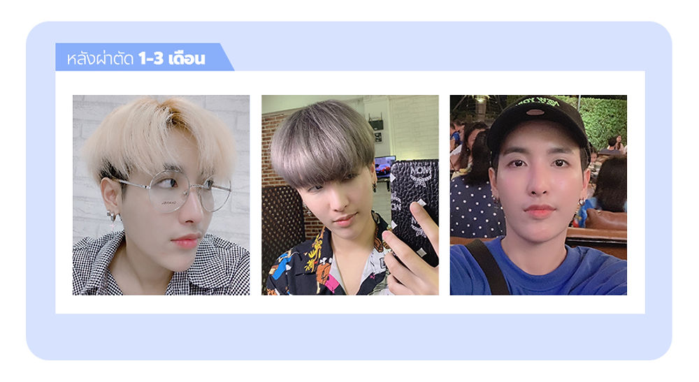 สวย หล่อ ครบจบในที่เดียว โรงพยาบาลศัลยกรรมมาร์เบิ้ล MARBLE PLASTIC SURGERY