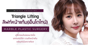 Triangle Lifting ลิฟท์หน้าแก้ม(เอ็นโดไทน์) ที่มาร์เบิ้ล MARBLE PLASTIC SURGERY