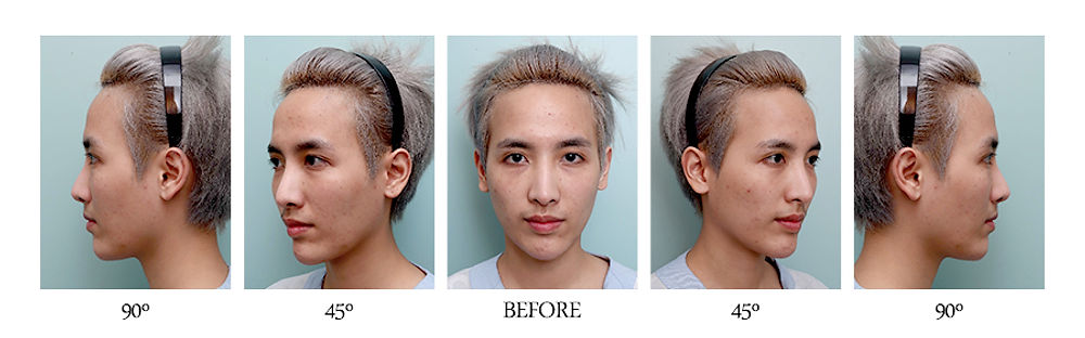 สวย หล่อ ครบจบในที่เดียว โรงพยาบาลศัลยกรรมมาร์เบิ้ล MARBLE PLASTIC SURGERY