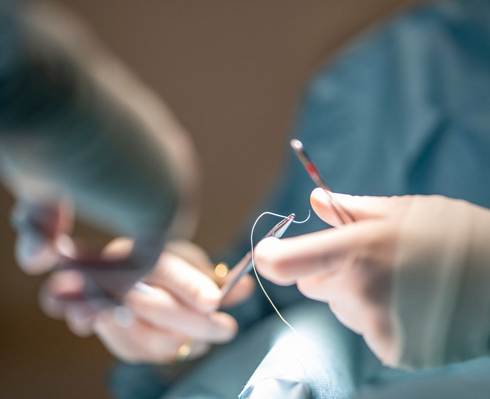 To Be Plastic Surgery