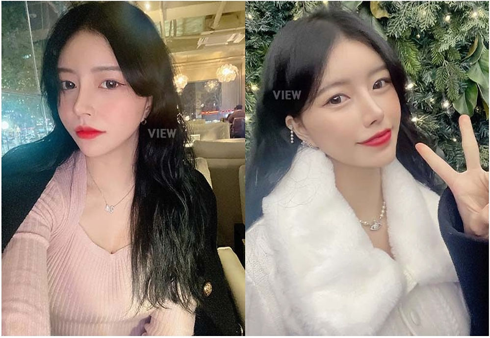 โครงหน้า 3 จุด / ศัลยกรรมจมูก โรงพยาบาลวิว VIEW Plastic Surgery