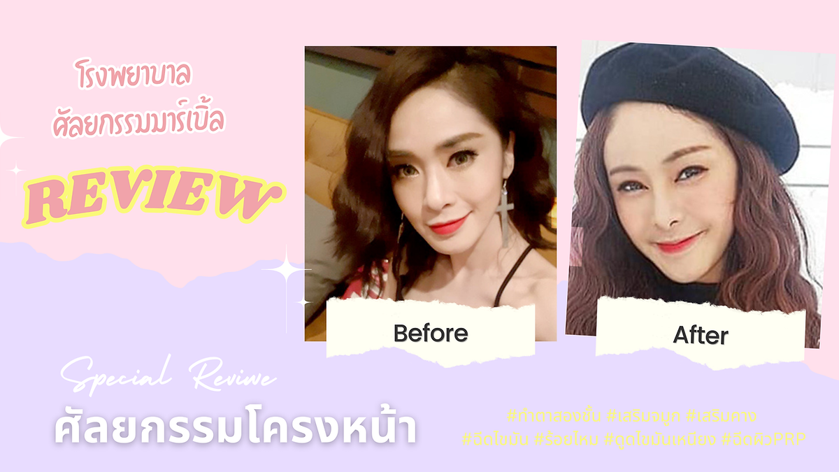 Cover image for the Korean plastic surgery hospitals section