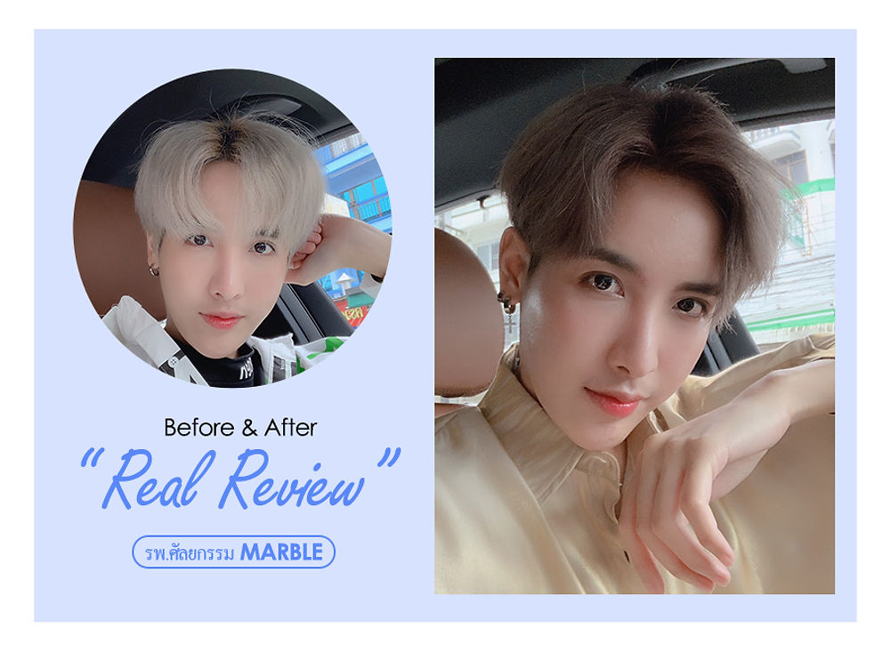 สวย หล่อ ครบจบในที่เดียว โรงพยาบาลศัลยกรรมมาร์เบิ้ล MARBLE PLASTIC SURGERY
