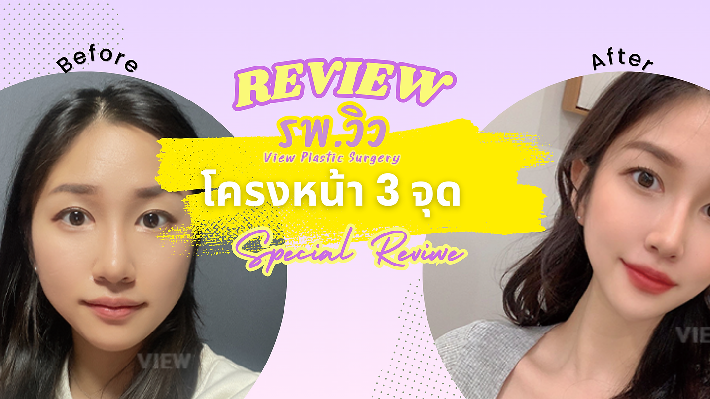 โครงหน้า 3 จุด / ร้อยไหม / ฉีดไขมันหน้า / ดูดไขมันเหนียง ศัลยกรรมปรับโครงหน้าที่ โรงพยาบาลวิว VIEW Plastic Surgery