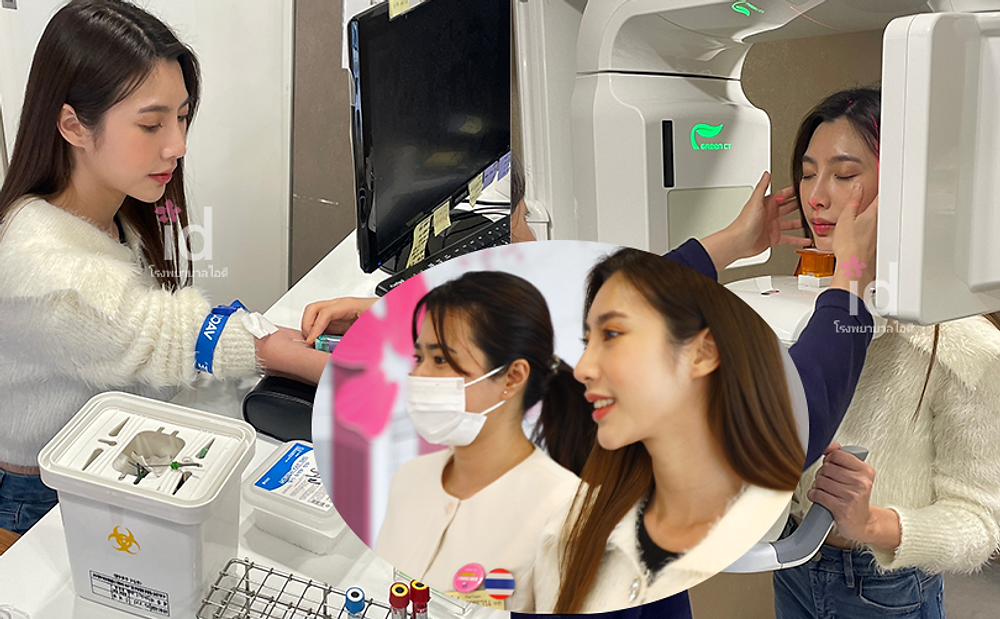 รีวิวศัลยกรรมเสริมจมูก และหน้าผากด้วยไขมันตัวเอง โรงพยาบาลไอดี ID Hospital