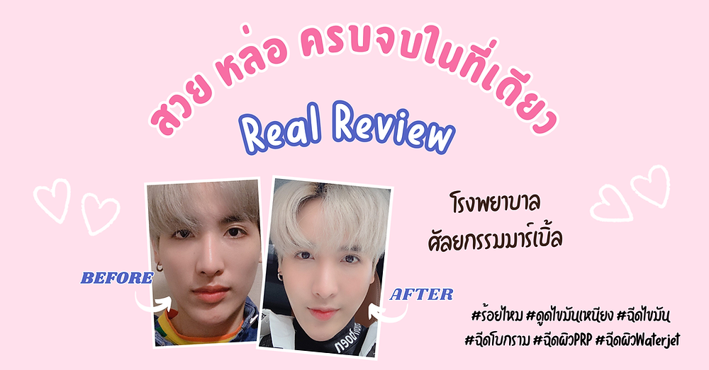 สวย หล่อ ครบจบในที่เดียว โรงพยาบาลศัลยกรรมมาร์เบิ้ล MARBLE PLASTIC SURGERY
