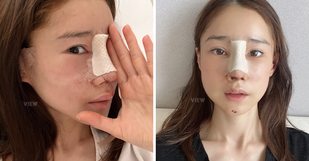 โรงพยาบาลวิว View Plastic Surgery