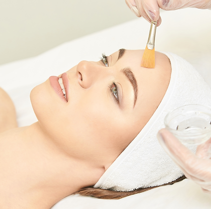 chemical peel- website.png