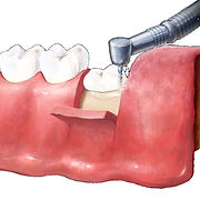 cirugia-dental.jpg