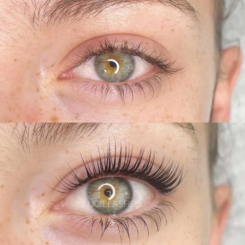 eyes.webp
