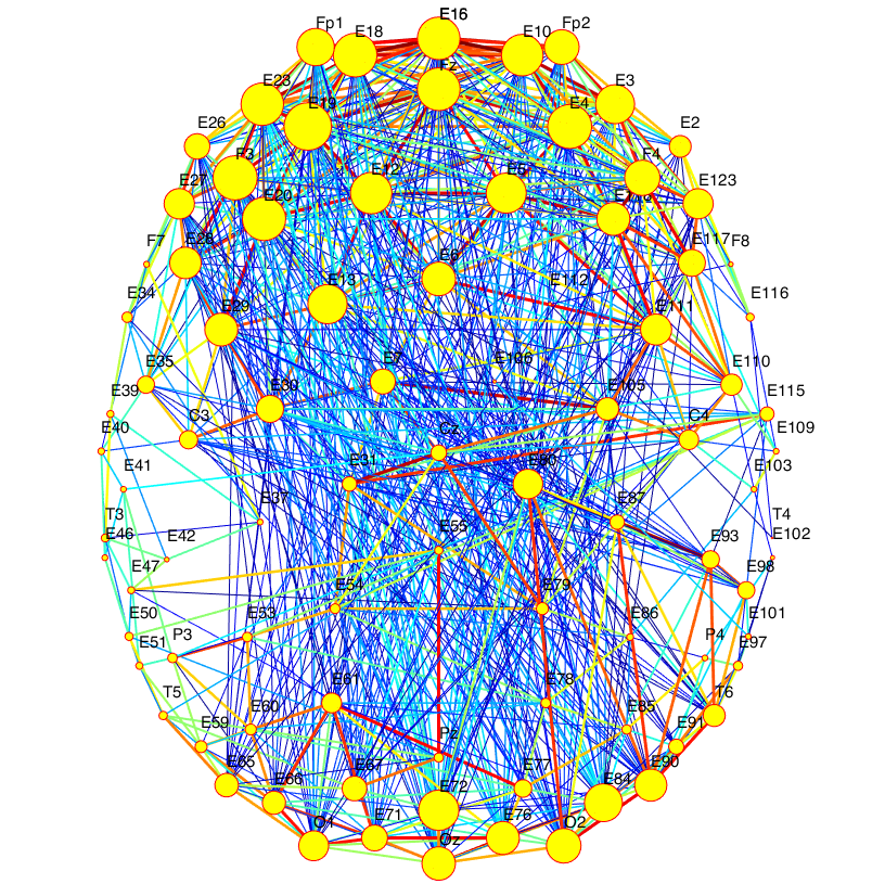 Tutorial for complex brain networks 