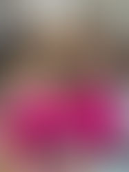 Cães cadeirantes precisam de companhia o dia todo?