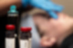 Microneedling pen and vials for Advanced Clinical Skincare