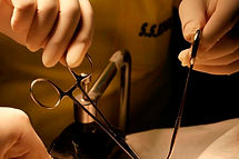 conventional circumcision.jpeg