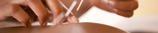 maine acupuncture