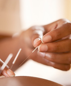 Acupuncture Yorkton