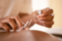 Acupuncture