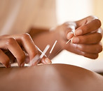 Terapia de acupuntura