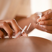 Acupuncture