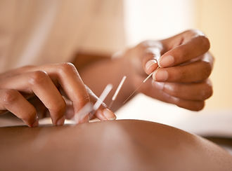Médecine chinoise, Acupuncture, Ventouses, Bilan Énergétique Paris