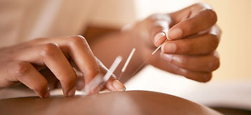 Acupuncture drainage lymphatique essonne
