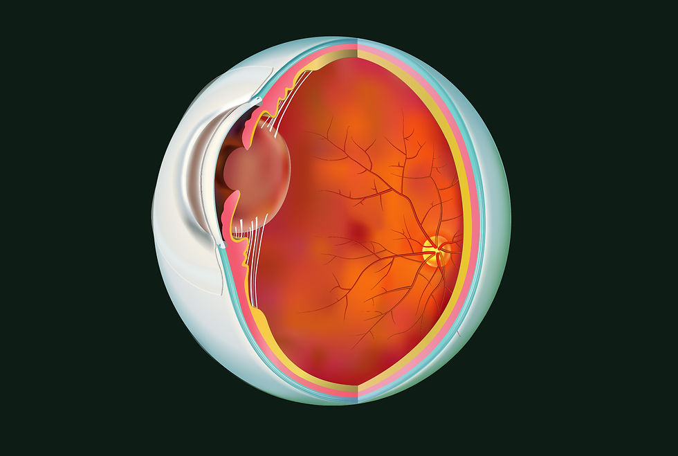 Macular Degeneration (AMD)