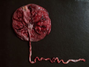 Unveiling the Mystery: What are Placenta Encapsulation Benefits?