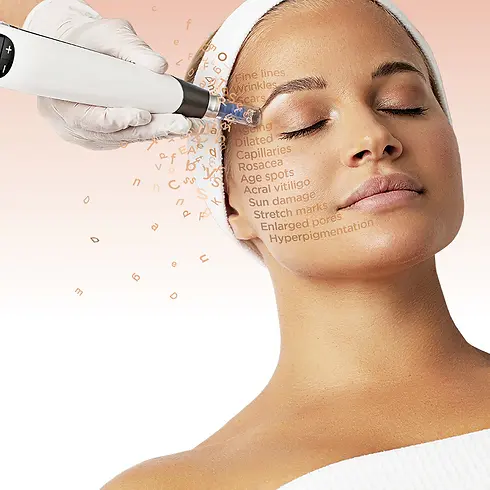 Dermapen4AllNEWGlobalSkinNeedlingSystem_1200x1200_crop_center.webp