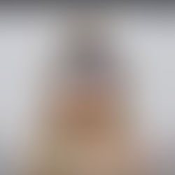 Seeing Clearly in the Sun: The Art of Precision for Perfectly Fitted Progressive Sunglasses