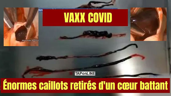 CAILOTS VIDEO.JPG