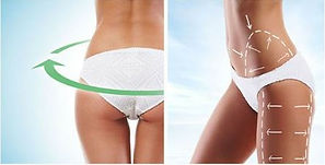 SLIM PATCH 0001.JPG