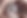 Keratoconus.png