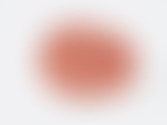 #335 Inde i Tesfayes hjerne